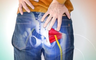 Sindrome del Piriforme: Come Riconoscerla, Curarla e Tornare al Benessere