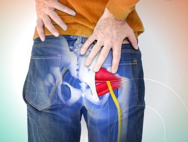Illustrazione anatomica del muscolo piriforme e del nervo sciatico nella regione glutea
